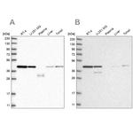 PPP1R8 Antibody in Western Blot (WB)