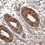 WEE2 Antibody in Immunohistochemistry (Paraffin) (IHC (P))