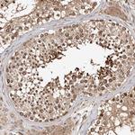 WEE2 Antibody in Immunohistochemistry (Paraffin) (IHC (P))