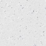 HMGCS2 Antibody in Immunohistochemistry (Paraffin) (IHC (P))