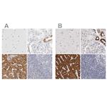 HMGCS2 Antibody in Immunohistochemistry (IHC)