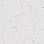 HMGCS2 Antibody in Immunohistochemistry (IHC)