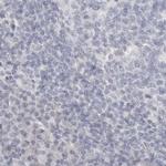 HMGCS2 Antibody in Immunohistochemistry (IHC)