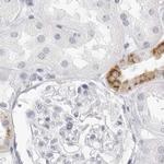 HMGCS2 Antibody in Immunohistochemistry (IHC)