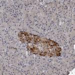 RC3H1 Antibody in Immunohistochemistry (Paraffin) (IHC (P))