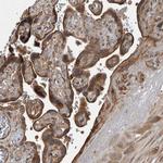 EXOC8 Antibody in Immunohistochemistry (Paraffin) (IHC (P))