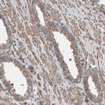 EXOC8 Antibody in Immunohistochemistry (Paraffin) (IHC (P))