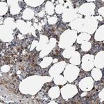 EXOC8 Antibody in Immunohistochemistry (IHC)