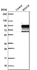 EXOC8 Antibody in Western Blot (WB)