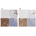 HMGCS2 Antibody in Immunohistochemistry (IHC)