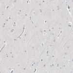 HMGCS2 Antibody in Immunohistochemistry (IHC)