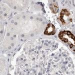 HMGCS2 Antibody in Immunohistochemistry (IHC)