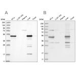 HMGCS2 Antibody in Western Blot (WB)