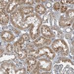 GAK Antibody in Immunohistochemistry (Paraffin) (IHC (P))