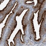 GAK Antibody in Immunohistochemistry (Paraffin) (IHC (P))