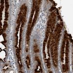 GAK Antibody in Immunohistochemistry (Paraffin) (IHC (P))