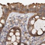 UFC1 Antibody in Immunohistochemistry (IHC)