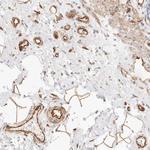 NUS1 Antibody in Immunohistochemistry (Paraffin) (IHC (P))