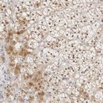 POLR3C Antibody in Immunohistochemistry (Paraffin) (IHC (P))