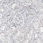 VEZF1 Antibody in Immunohistochemistry (IHC)