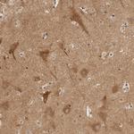 ATL1 Antibody in Immunohistochemistry (Paraffin) (IHC (P))