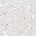 ATL1 Antibody in Immunohistochemistry (IHC)