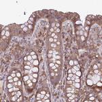 MOCS3 Antibody in Immunohistochemistry (IHC)