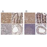 SORBS1 Antibody in Immunohistochemistry (IHC)