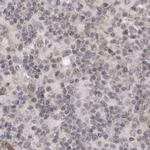 SORBS1 Antibody in Immunohistochemistry (IHC)