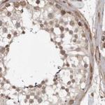 SORBS1 Antibody in Immunohistochemistry (IHC)