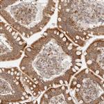 MRPL55 Antibody in Immunohistochemistry (Paraffin) (IHC (P))