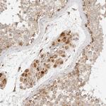 MRPL55 Antibody in Immunohistochemistry (Paraffin) (IHC (P))