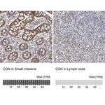 CGN Antibody in Immunohistochemistry (IHC)