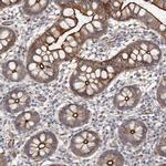 CGN Antibody in Immunohistochemistry (IHC)