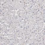 KIF26B Antibody in Immunohistochemistry (Paraffin) (IHC (P))