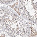 KIF26B Antibody in Immunohistochemistry (Paraffin) (IHC (P))