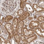 RABIF Antibody in Immunohistochemistry (Paraffin) (IHC (P))