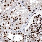 BCLAF1 Antibody in Immunohistochemistry (Paraffin) (IHC (P))