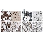 BCLAF1 Antibody in Immunohistochemistry (IHC)