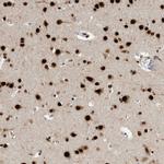 BCLAF1 Antibody in Immunohistochemistry (IHC)