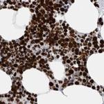 BCLAF1 Antibody in Immunohistochemistry (IHC)