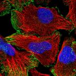 Neogenin Antibody in Immunocytochemistry (ICC/IF)