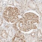 Neogenin Antibody in Immunohistochemistry (Paraffin) (IHC (P))