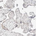 Neogenin Antibody in Immunohistochemistry (Paraffin) (IHC (P))