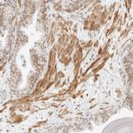 Neogenin Antibody in Immunohistochemistry (Paraffin) (IHC (P))