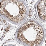 CKAP2 Antibody in Immunohistochemistry (IHC)