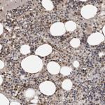 CKAP2 Antibody in Immunohistochemistry (IHC)