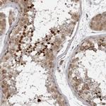 CKAP2 Antibody in Immunohistochemistry (IHC)