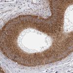 CDK5RAP3 Antibody in Immunohistochemistry (Paraffin) (IHC (P))