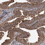 CDK5RAP3 Antibody in Immunohistochemistry (Paraffin) (IHC (P))